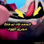 ماذا تفعل عند إرتخاء عضلة اللسان ؟؟