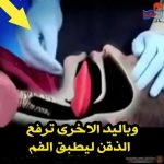 ماذا تفعل عند إرتخاء عضلة اللسان ؟؟