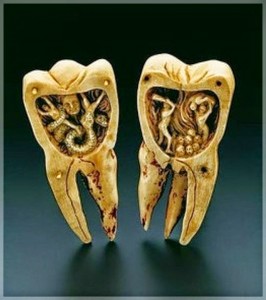 Faster home remedies for toothache